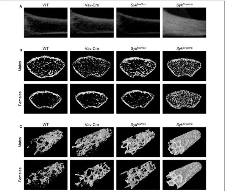 FIGURE 3 | Micro-CT analysis of hematopoietic Syk-deficient mice. Representative micro-CT images of the femurs of 9-week-old mice of wild type (WT) and the indicated mutant mice