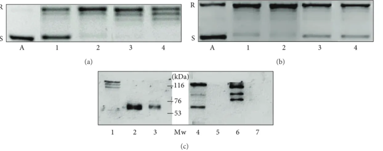 Figure 2: Differences of topoisomerase I activity in liver samples (a) and in hepatoma cells (b) (representative image of three independent experiments)