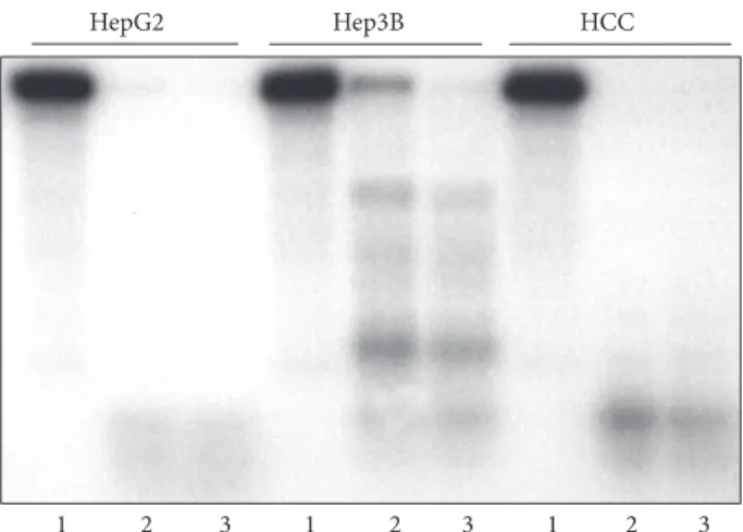 Figure 3: Differences of topoisomerase I plasmid cleavage activity trapped by TpT in liver samples and in hepatoma cells  (represen-tative image of three independent experiments)