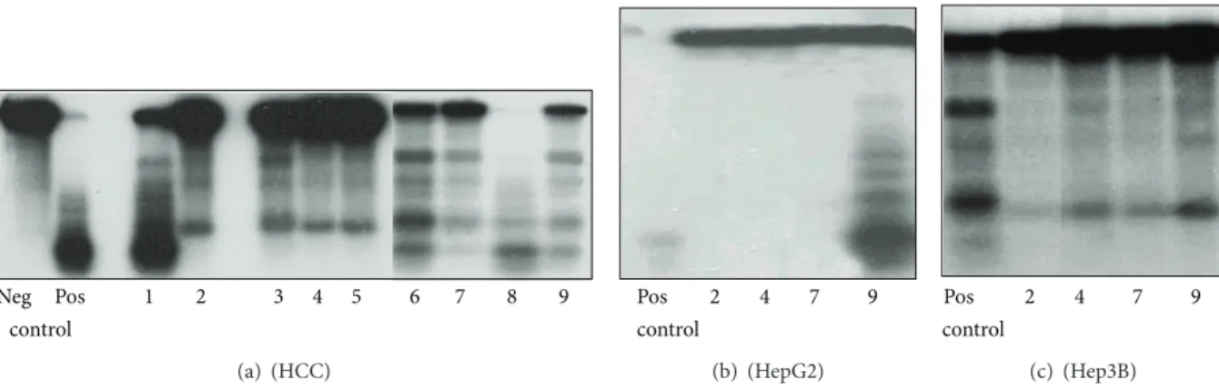 Figure 4: Inhibitory effect of heparin, normal and peritumoral liver heparane sulfate (HS), and hepatocellular carcinoma heparane sulfate on the TpT induced topo I cleavage reaction (representative image of three independent experiments)