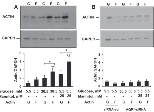 Fig. 6. The effect of AQP1 on G/F actin redistribution in human induced pluripotent stem cells exposed to high glucose-induced hyperosmolar stress
