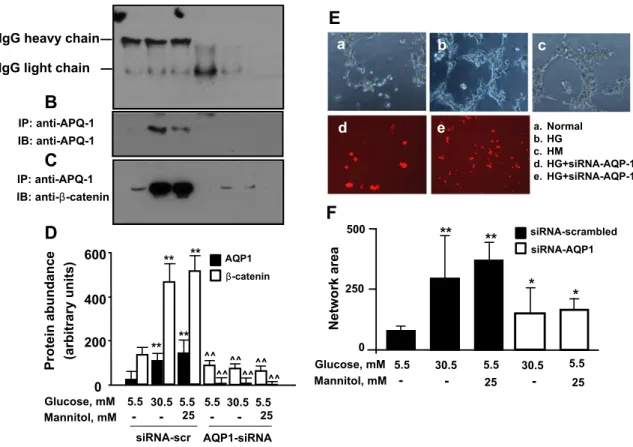 Fig. 7. A–D and E–F. Co-immunoprecipitation of AQP1 and beta-catenin in human induced pluripotent stem cells exposed to high glucose-induced hyperosmolar stress (A–D)