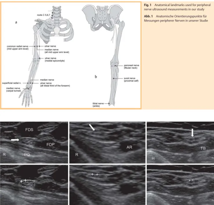 Fig. 2 Normal ultrasound images of three different nerves. On the lower images, the tracing used to measure the cross-sectional area is shown.