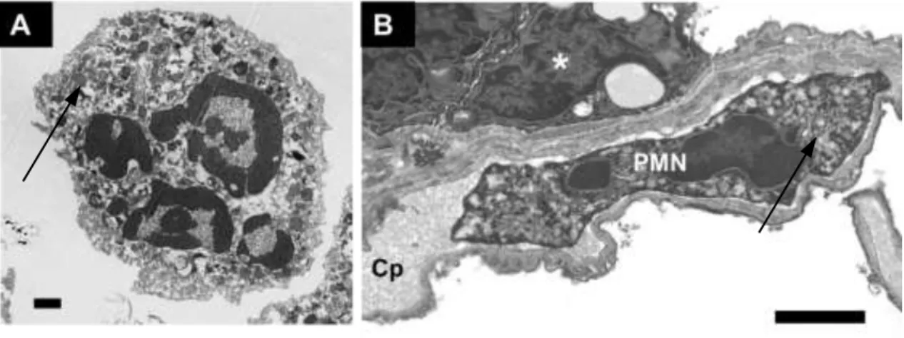 1. ábra. A neutrofil granulociták sejtalakjaik sokfélesége elektronmikroszkópos felvételeken