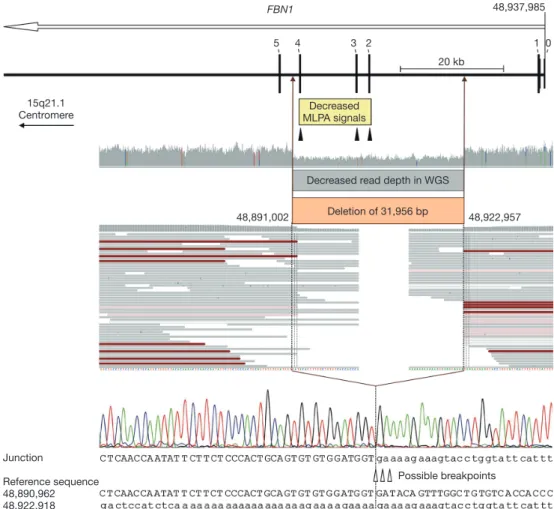 Figure 1 Deletion characterization. Schematic representation of the 32-kb FBN1 deletion comprising coding exons 2-4 as well as an  overview of the corresponding results of MLPA, WGS, and Sanger sequencing analyses