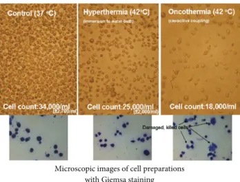 Figure 4: Lethality comparison with traditional hyperthermia in vitro experiments (fixed suspension sample): HL-60 leukemia cell line.