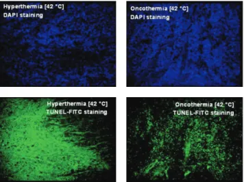 Figure 3: Upper panel: DAPI staining (stains the double strains of DNA only); lower panel: TUNEL-FITC staining (enzymatic label of the strain-break of the DNA)