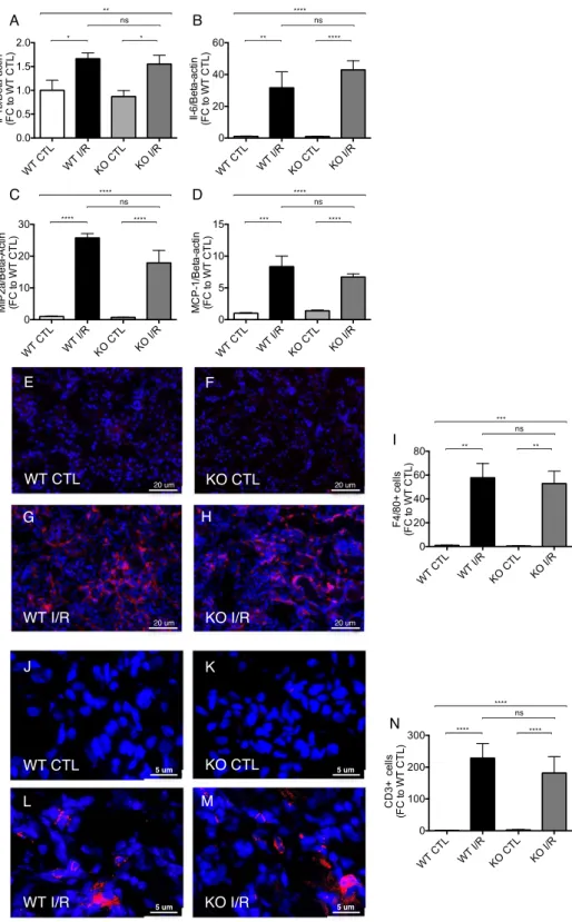 Figure 5.  Inflammatory gene expression and cell influx upon unilateral renal I/Rinjury