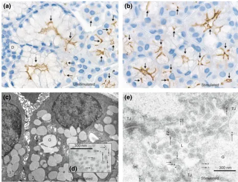 Figure 1 AQP5 distribution in human labial salivary glands of normal subjects by immunohistochemistry