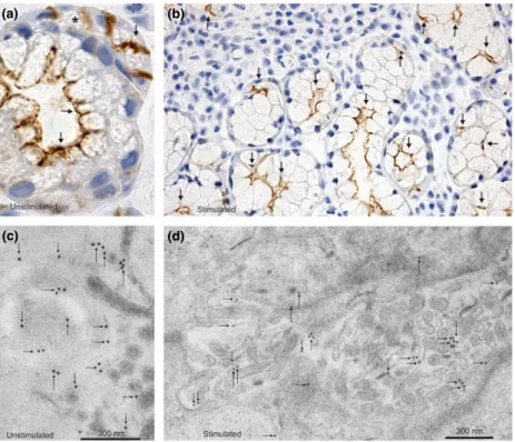 Figure 2 AQP5 distribution in human labial salivary glands of Sj € ogren ’ s syndrome (SS) patients by immunohistochemistry