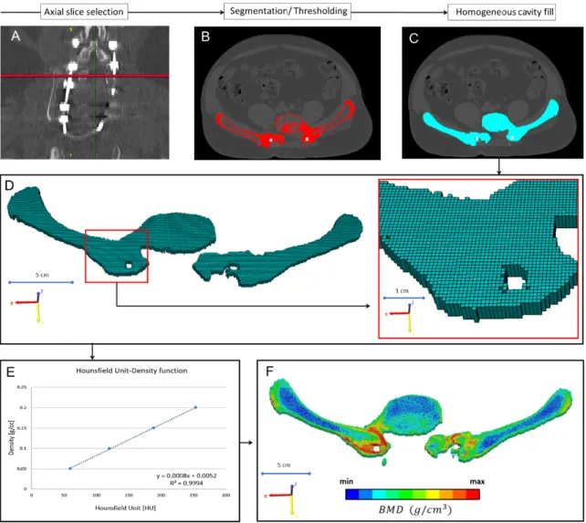 Figure 12. Evaluation of the bony fusion process between the LV vertebra and the two  iliac bone