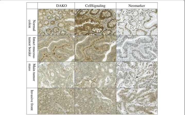 Fig. 2 Immunohistochemical images of the investigated regions according to the respective PTEN antibody