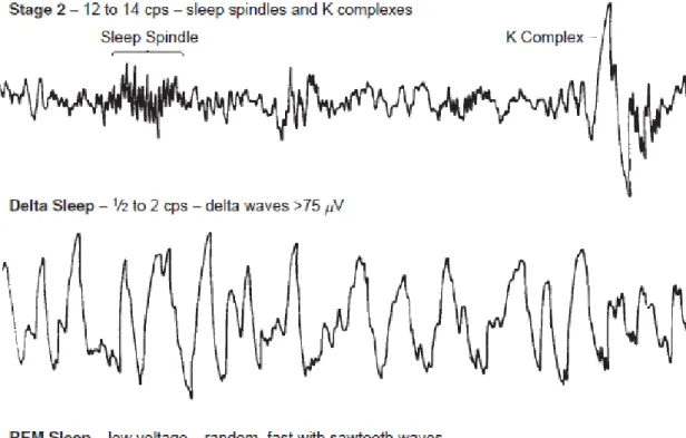 Figure 1. “EEG patterns of human sleep states and stages”. Figure and caption from