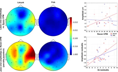 1. ábra. A lassú alvási orsók amplitúdójának normál (fels ő  panelek) és életkorra korrigált  parciális (alsó panelek) korrelációja az Raven CPM eredményekkel 4-8 éves lánygyermekeknél 