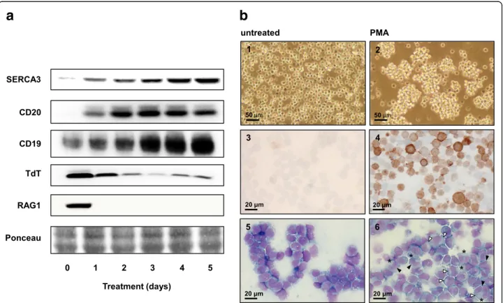 Fig. 4 Induction of differentiation by PMA in Kasumi-2 cells. a: Cells were treated with 10 −7 M PMA during 5 days and the expression of SERCA3, CD20, TdT, RAG-1 and CD19 was determined by Western blotting daily