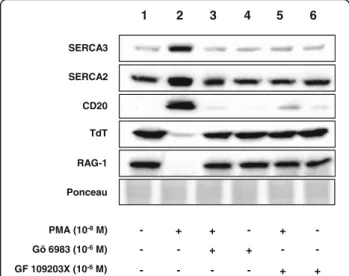 Figure S1 and and Additional file 3 Figure: S2 for the ex- ex-pression profile of SERCA3, SERCA2 and various  estab-lished differentiation markers, respectively), suggesting that enhanced SERCA3 expression occurs during normal B lymphocyte differentiation