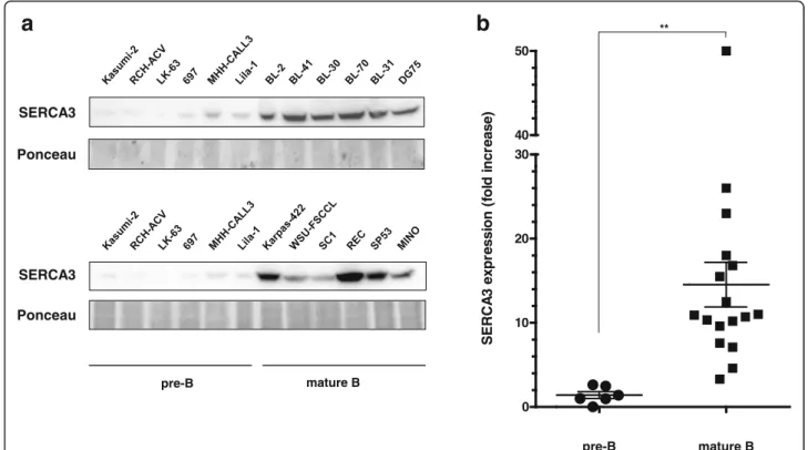 Fig. 7 SERCA3 expression levels in precursor B and mature B cell lines. a: SERCA3 expression was determined by semi-quantitative Western blotting using total protein lysates prepared from various untreated precursor-B and mature B cell lines (see Additiona