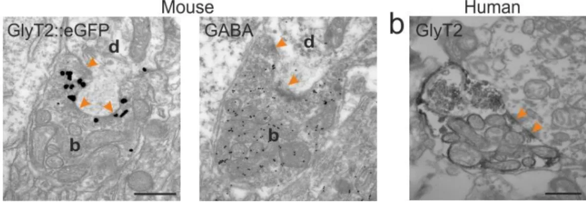 Figure 4.1.5. Electronmicrographs of glycinergic terminals in mouse and human. 