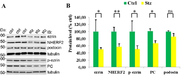 Figure 7: Protein levels in Streptozotocin-injected and control rats. 