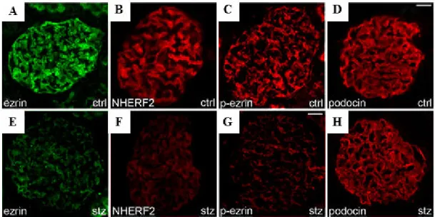 Figure 8: Immunofluorescence images of glomeruli of control (A-D) and streptozotocin-injected (E- (E-H) rats stained for ezrin, NHERF2, phosphorylated ezrin (p-ezrin), and podocin