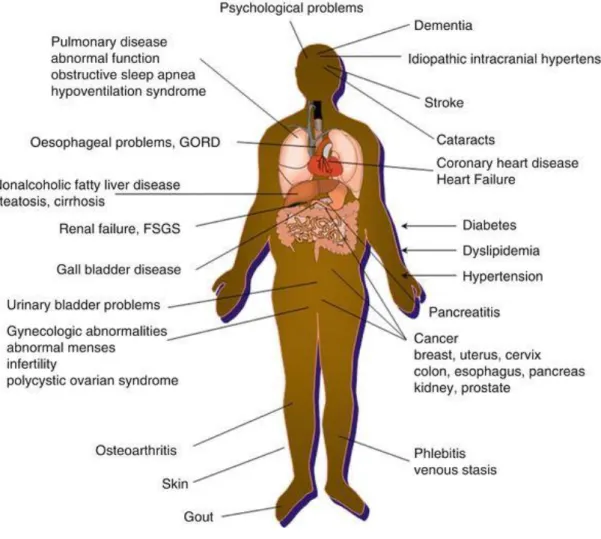 Figure 2. Medical complications of obesity. 