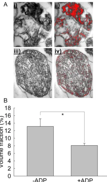 Figure  6:  Quantification  of  the  Ca 2+ – P i -rich  areas  of  Ca 2+ -loaded  Artemia  mitochondria by adaptive thresholding