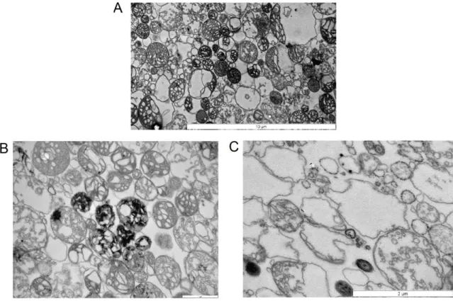 Figure  10:  TEM  images  of  Cyclops  mitochondria.  Panel  A  shows  control,  panel  B  sows  mitochondria  loaded with Ca 2+  in the experiment shown on Fig