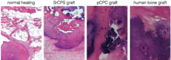 Figure  2:  Representative  hematoxylin  and  eosin  stained histological section of the distal end of rat-tail  vertebra  after  12  weeks  of  normal  healing  and  SrCPS, pCPC and human bone graft implantation.