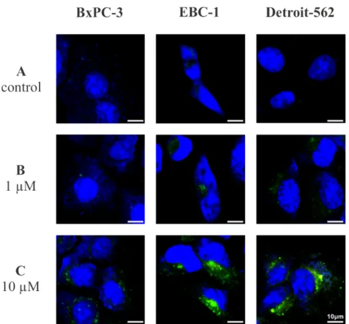 Figure 1: Confocal images of the untreated and the [Lys 8 (FITC)]-GnRH-III treated cancer cells