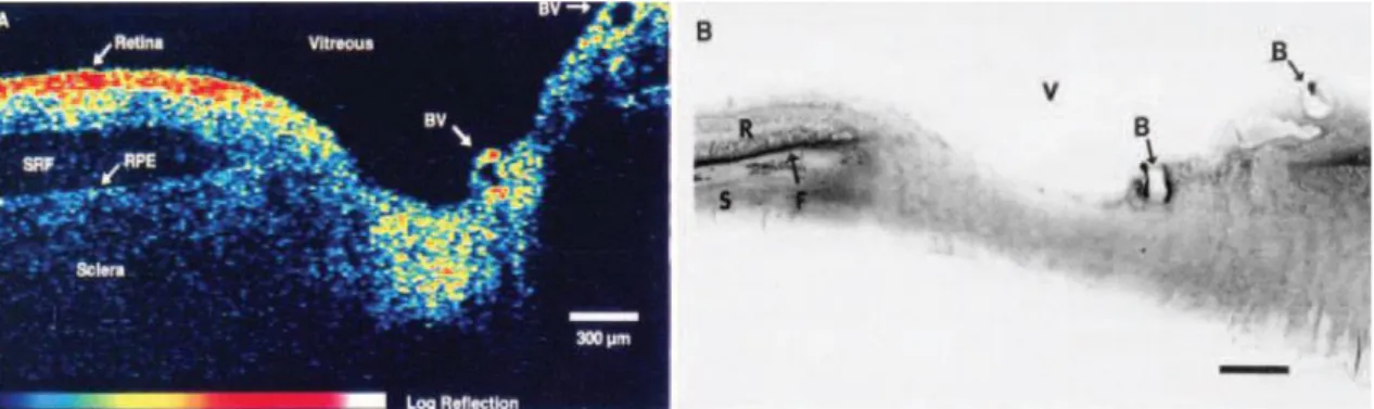 Figure  5.:  Right: The  first  ever OCT image published by James  Fujimoto’s lab at  the  Massachusetts Institute of Technology of an ex vivo human retina and optic nerve head