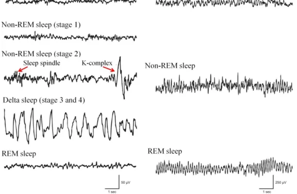 Figure  1.  Electroencephalographic  (EEG)  recordings  of  different  vigilance  stages  in  human  and  rat