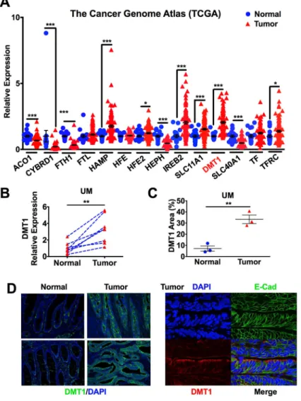 Figure 1. DMT1 is overexpressed in CRC