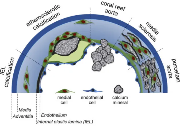 Figure 1. The different types of calcification. Figure by Bostrom et al. [56] 