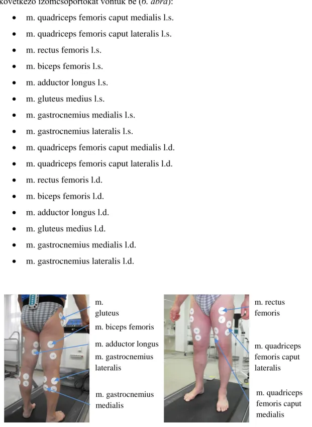 6. ábra: EMG érzékelők elhelyezése az alsó végtagon m. adductor longus m. gastrocnemius lateralis m