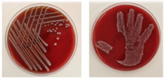 21. ábra: A baktérium teszttörzs véres agaron és a mérés eredménye tenyésztés után. 