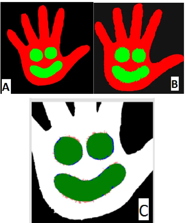 27. ábra: Az (A) felvételen az UV sugárzásban készített eredménykép digitális kiértékelése, a (B)  felvételen a mikrobiológia tenyésztés eredményének digitális képfeldolgozás során kapott 