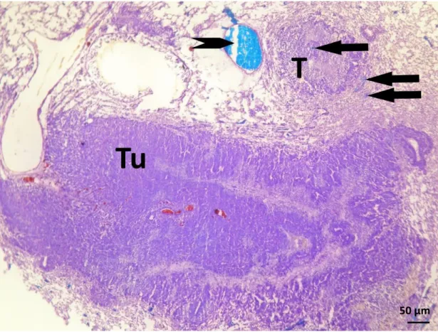 12. ábra: Bronchiális artéria által ellátott metasztázis (Tu) fagyasztott metszetének  fénymikroszkópos  képe  (toluidinkék  festés)