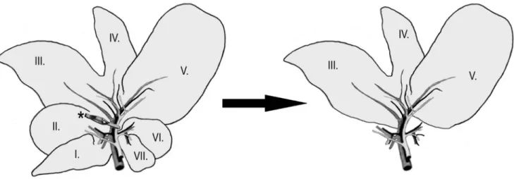Figure 1. Liver lobes III, IV, V were subjected to 60 min ischemia by clamping of the biliovascular trunk using an atraumatic microvascular clip (asterix)