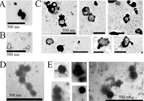 Figure 7.  LDL binds onto isolated MVs and EXOs in vitro. (A,B) TEM analysis of commercial LDL (A) and  cell line-derived MVs (B) using the “osmification-on-grid” method