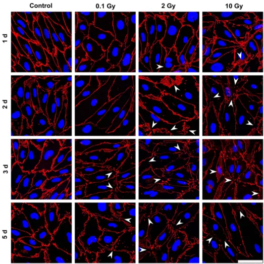 Figure 5. Effect of irradiation on claudin-5 immunostaining in mouse brain endothelial cells