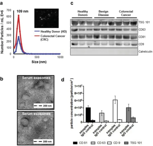 Figure 1. (a) Identification of serum exosomes by nanoparticle tracking analysis (NTA) using ZetaView®, (b) by transmission electron microscopy, (c) by Western Blot for exosome-associated proteins and (d) by fluorescent NTA for exosome-associated protein m