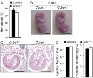 Figure .  Non-anemic Ccbe /  embryos survive to late gestation  with normal cardiovascular function