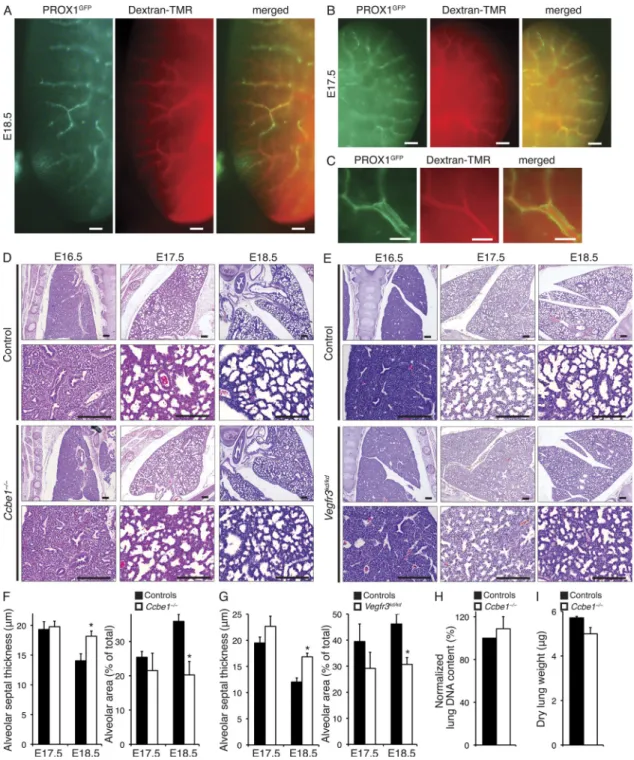 Figure .  The lung lymphatic vascular network is functional during late gestation. (A) Rhodamine-labeled dextran (dextran-TMR) injected into the  lungs of live E18.5 Prox1 GFP  transgenic embryos is selectively taken up by GFP +  lymphatic vessels