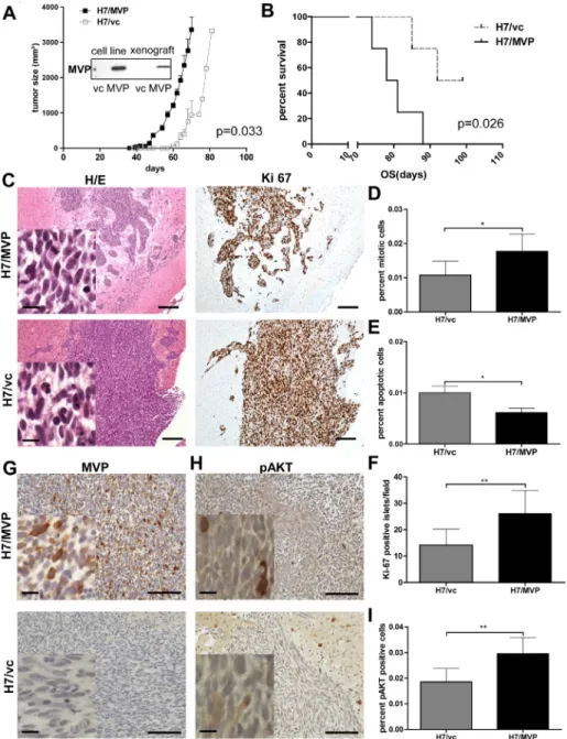 Figure 6: MVP supports GBM xenograft growth and invasiveness.  A and B. The impact of MVP status on subcutaneous tumour  formation dynamics (A) and overall survival (OS) time of mice (B) after inoculation of 1 x 10 6  H7/MVP and H7/vc cells is depicted