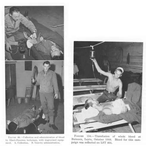 3. ábra: Transzfúziós eszközök a II. világháború idejéről (15.) 