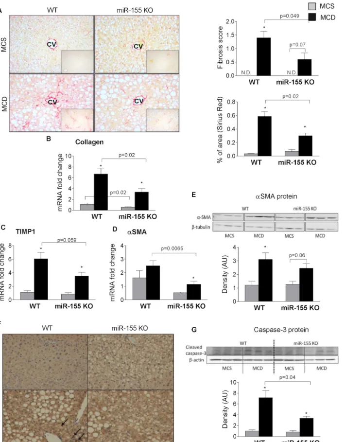 Fig 4. miR-155 deficiency attenuates liver fibrosis in MCD-steatohepatitis. Wild type (WT) and miR-155 deficient (KO) mice were fed with methionine- methionine-choline deficient (MCD) or supplemented (MCS) control diet for 5 weeks