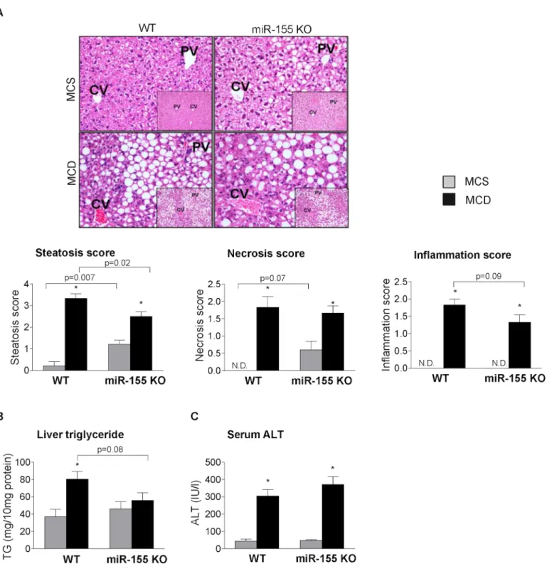 Fig 2. miR-155 deficiency does not prevent liver injury, but attenuates liver steatosis in MCD-steatohepatitis