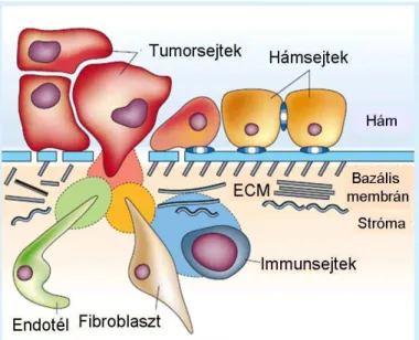 1. ábra. Az invazív karcinóma kialakulása, tumor-stróma interakció [11]. A hámban létrejött  daganatsejtek  áttörve  a  bazális  membránt  közvetlen  kapcsolatba  kerülnek  a  stróma  sejtes  elemeivel,  így  az  endotélsejtekkel,  fibroblasztokkal  és  im