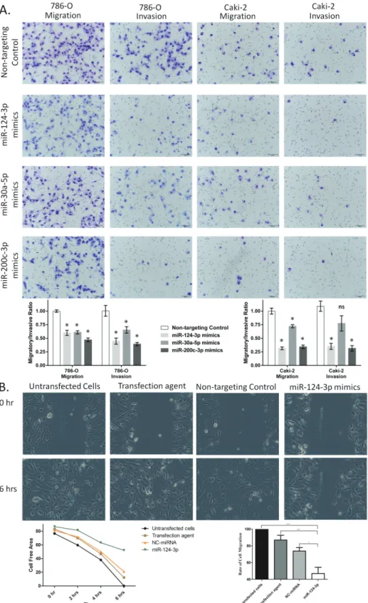 Figure 4: miR-124-3p, -30a-5p and -200c-3p effect on migration and invasion of kidney cancer cell lines
