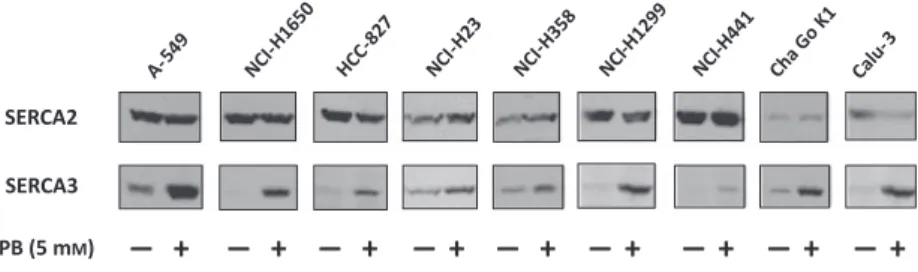 Fig. 2. Selective induction of SERCA3 protein expression in various lung adenocarcinoma cell lines